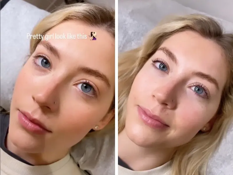 Are Lash Lifts Safe for Teenagers? 3 Are lash lifts safe for teenagers