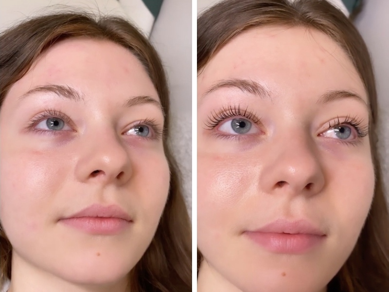 Can I wear contact lenses during a lash lift