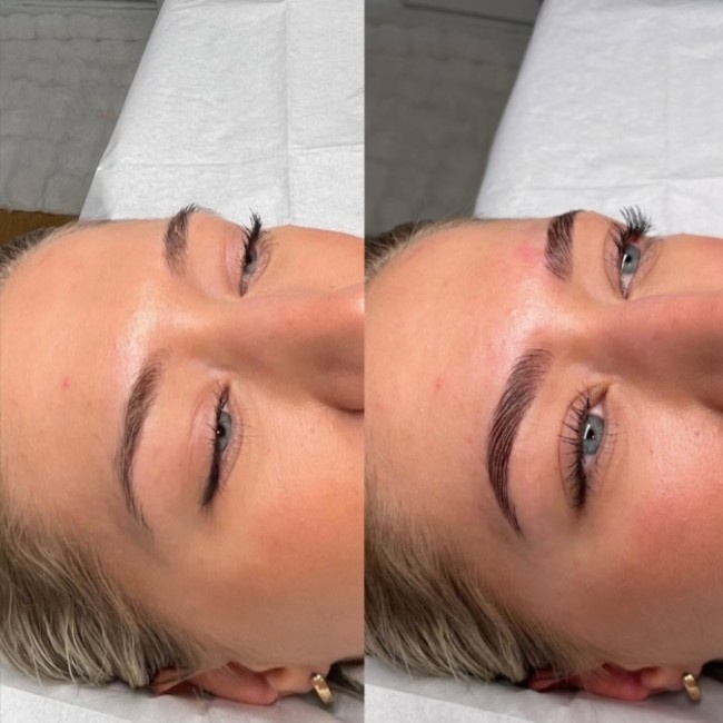 brow shaping Marietta