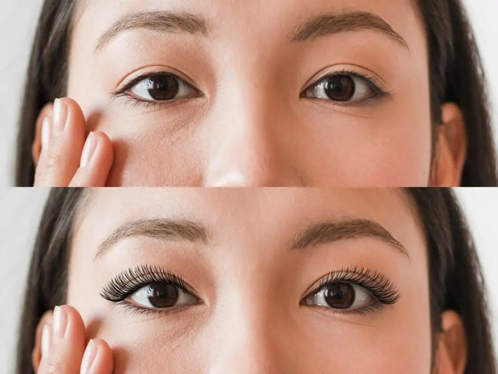 Chemical Burn Eyelash Extensions: Relief & Symptoms 3 Chemical burn eyelash extensions