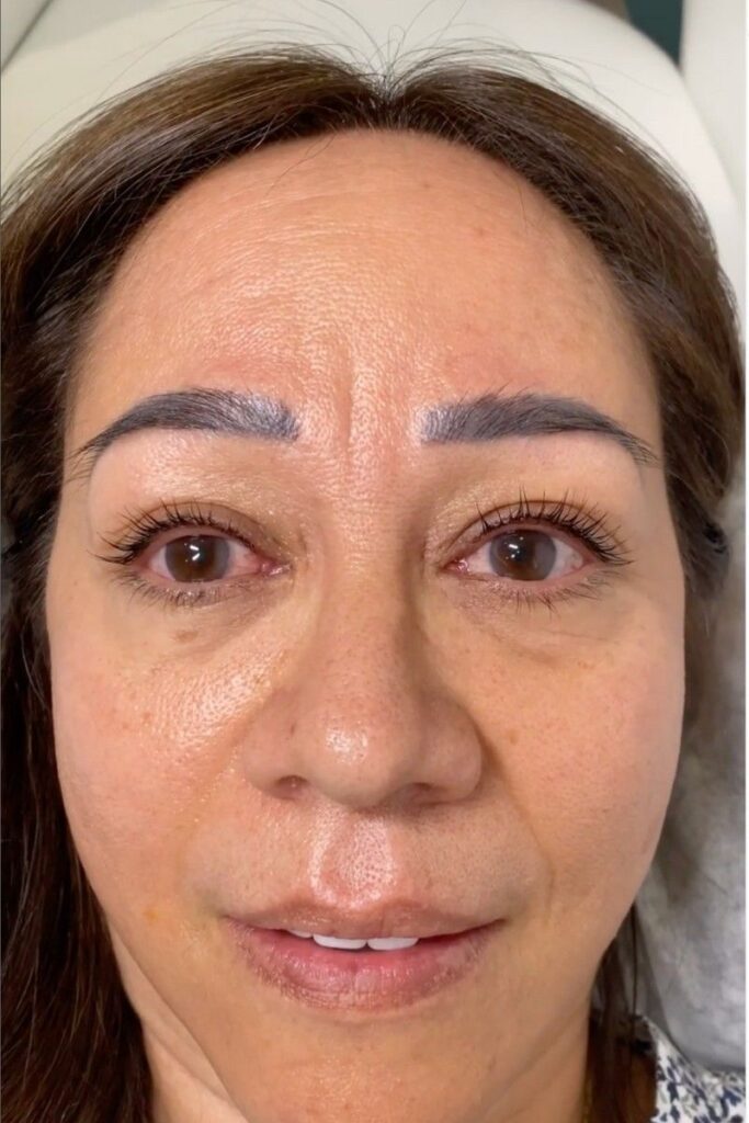 YUMI Keratin Lash Lift Kennesaw: The 12-Week Beauty Hack 2 yumi keratin lash lift Kennesaw