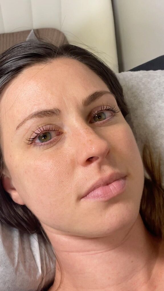 Korean Lash Lift vs Regular Lash Lift: What’s the Real Difference? 4 korean lash lift vs regular lash lift